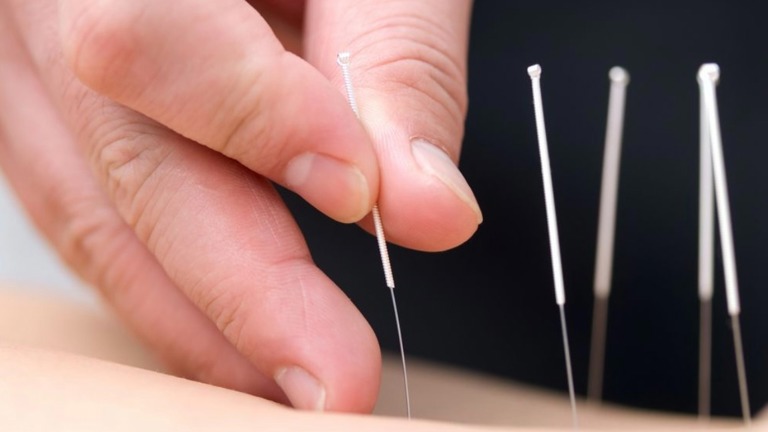Successful Acupuncture Practice For Sale! in Herndon, Virginia 