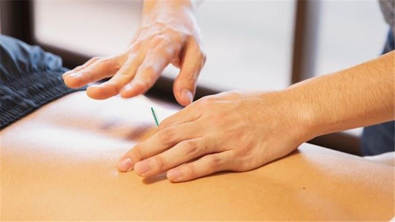 Acupuncture Business for Sale