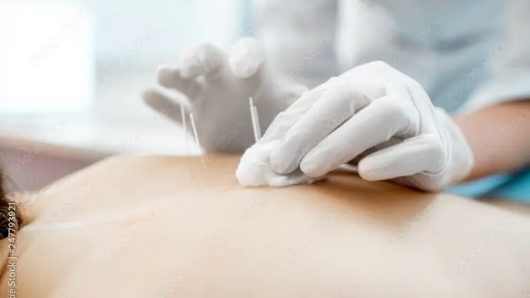 Profitable Naturopathic Medicine and Acupuncture Clinic