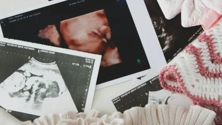 Established Elective Prenatal Imaging Business for Sale